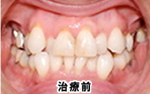 治療前